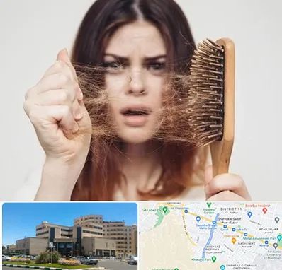 دکتر ریزش مو در صیاد شیرازی مشهد