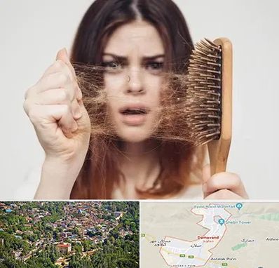 دکتر ریزش مو در دماوند