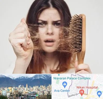 دکتر ریزش مو در آجودانیه 