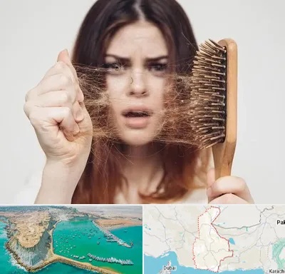 دکتر ریزش مو در سیستان و بلوچستان