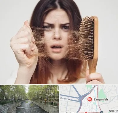 دکتر ریزش مو در زرگنده