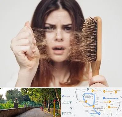 دکتر ریزش مو در بلوار گیلان رشت