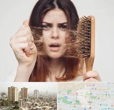دکتر ریزش مو در منطقه 5 تهران 