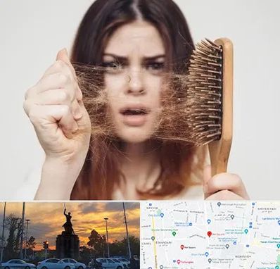 دکتر ریزش مو در میدان حر 