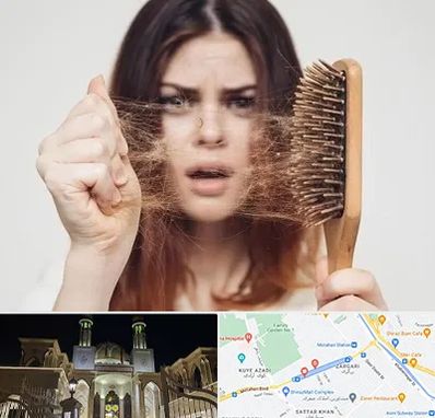 دکتر ریزش مو در زرگری شیراز