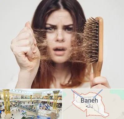 دکتر ریزش مو در بانه