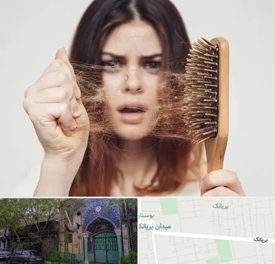 دکتر ریزش مو در بریانک