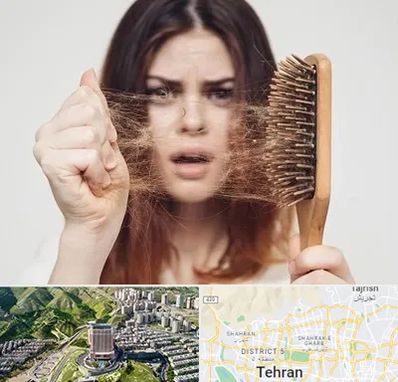 دکتر ریزش مو در شمال تهران 