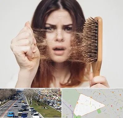 دکتر ریزش مو در احمدآباد مشهد