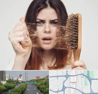 دکتر ریزش مو در توانیر