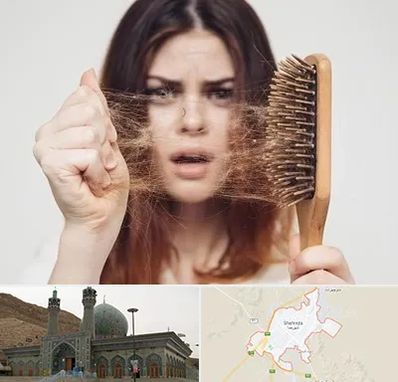 دکتر ریزش مو در شهرضا
