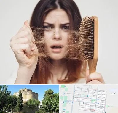 دکتر ریزش مو در مرداویج اصفهان