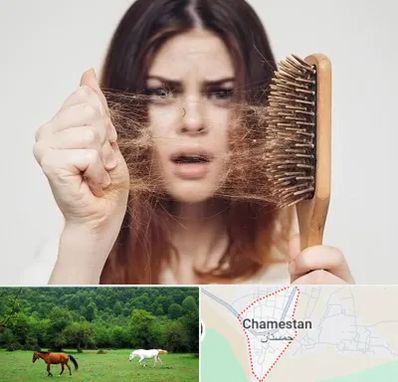 دکتر ریزش مو در چمستان