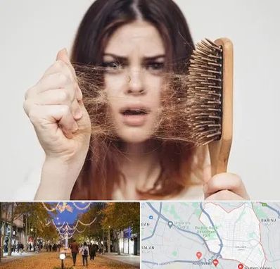 دکتر ریزش مو در ولیعصر ارومیه