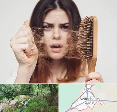 دکتر ریزش مو در آزادشهر