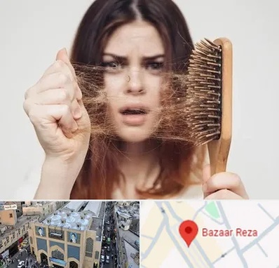 دکتر ریزش مو در بازار رضا مشهد