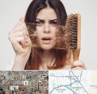دکتر ریزش مو در جنوب شرق تهران