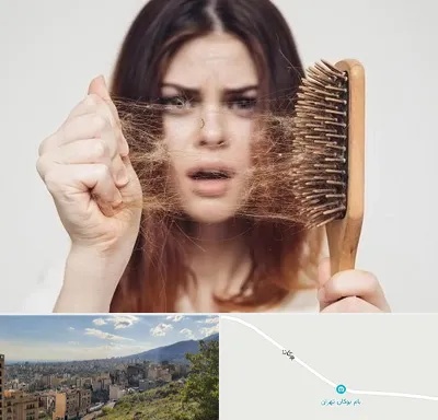 دکتر ریزش مو در بوکان تهران