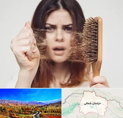 دکتر ریزش مو در خراسان شمالی