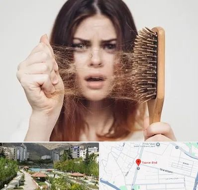 دکتر ریزش مو در بلوار تعاون