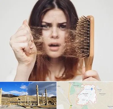 دکتر ریزش مو در مرودشت