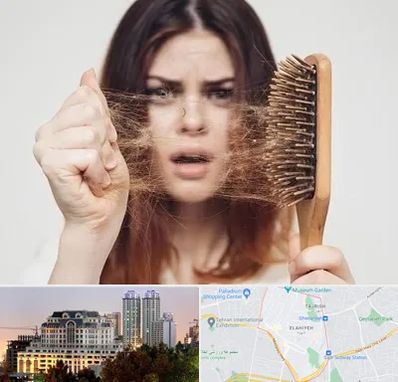 دکتر ریزش مو در فرشته 