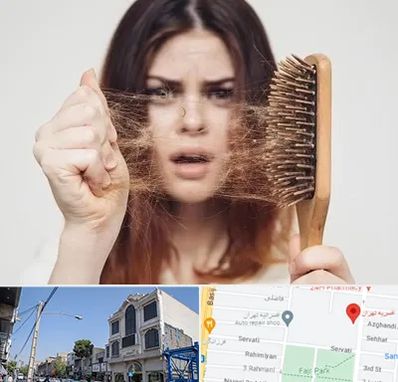 دکتر ریزش مو در افسریه 