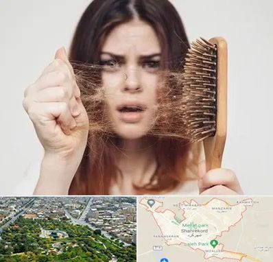 دکتر ریزش مو در شهرکرد