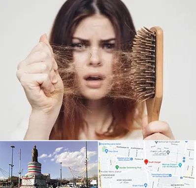 دکتر ریزش مو در کارگر جنوبی 