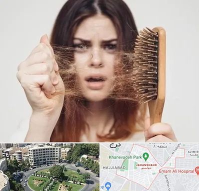 دکتر ریزش مو در جهانشهر کرج 