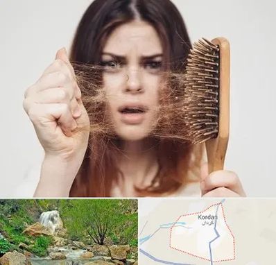 دکتر ریزش مو در کردان