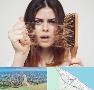 دکتر ریزش مو در تنکابن