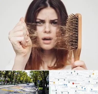 دکتر ریزش مو در میرداماد 