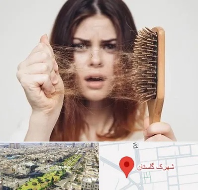 دکتر ریزش مو در شهرک گلستان