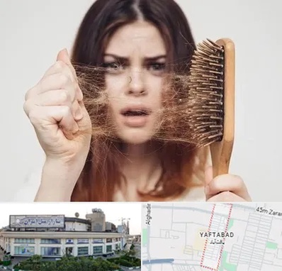 دکتر ریزش مو در یافت آباد
