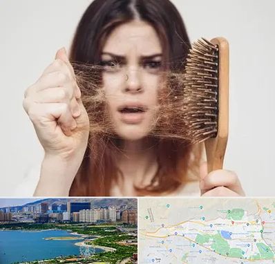 دکتر ریزش مو در منطقه 22 تهران 