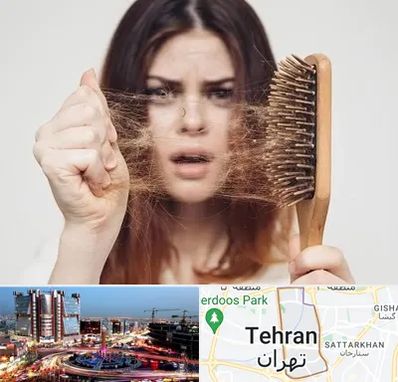 دکتر ریزش مو در صادقیه 