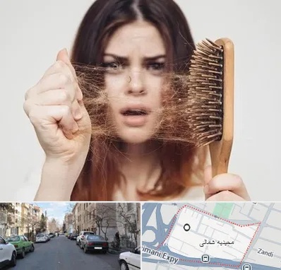 دکتر ریزش مو در مجیدیه شمالی
