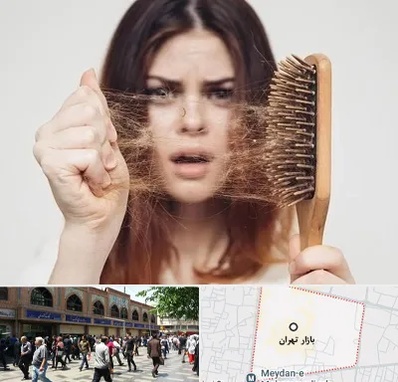 دکتر ریزش مو در بازار تهران