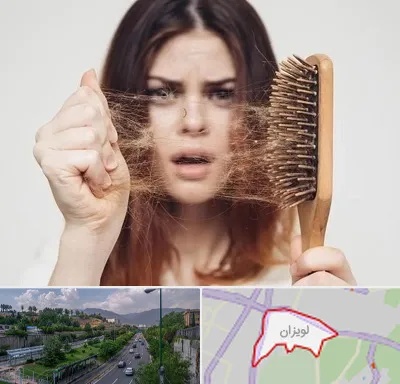 دکتر ریزش مو در لویزان