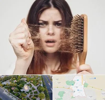 دکتر ریزش مو در کاشمر