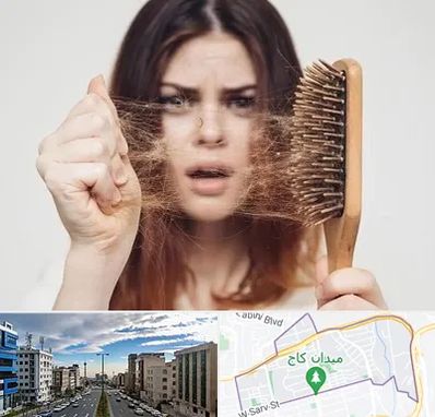 دکتر ریزش مو در سعادت آباد 