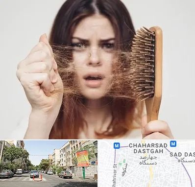 دکتر ریزش مو در چهارصد دستگاه 