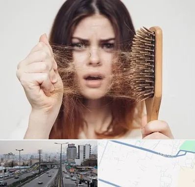 دکتر ریزش مو در بلوار ارتش