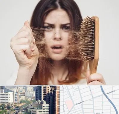 دکتر ریزش مو در خیابان بهشتی