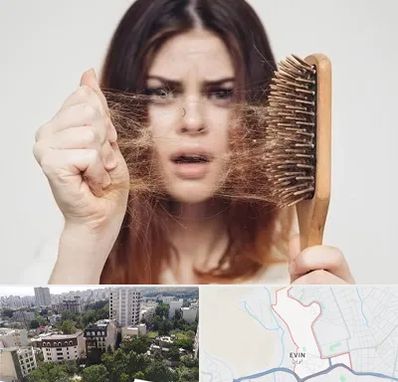 دکتر ریزش مو در اوین