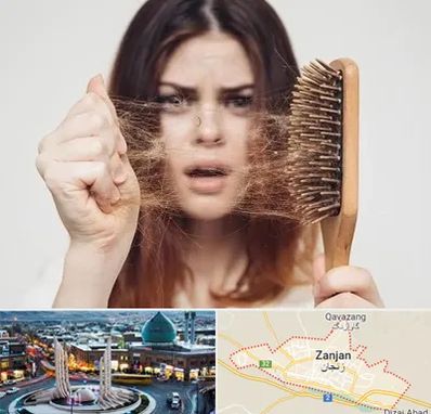 دکتر ریزش مو در زنجان