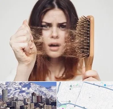 دکتر ریزش مو در ازگل