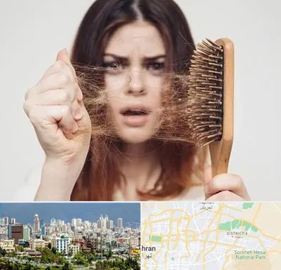 دکتر ریزش مو در شرق تهران 