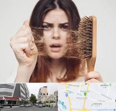 دکتر ریزش مو در بلوار فردوس 